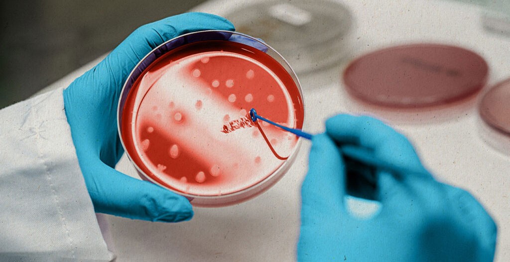 ‘स्टेम सेल’ थेरापीबाट एचआईभी संक्रमित महिलाको सफल उपचार !