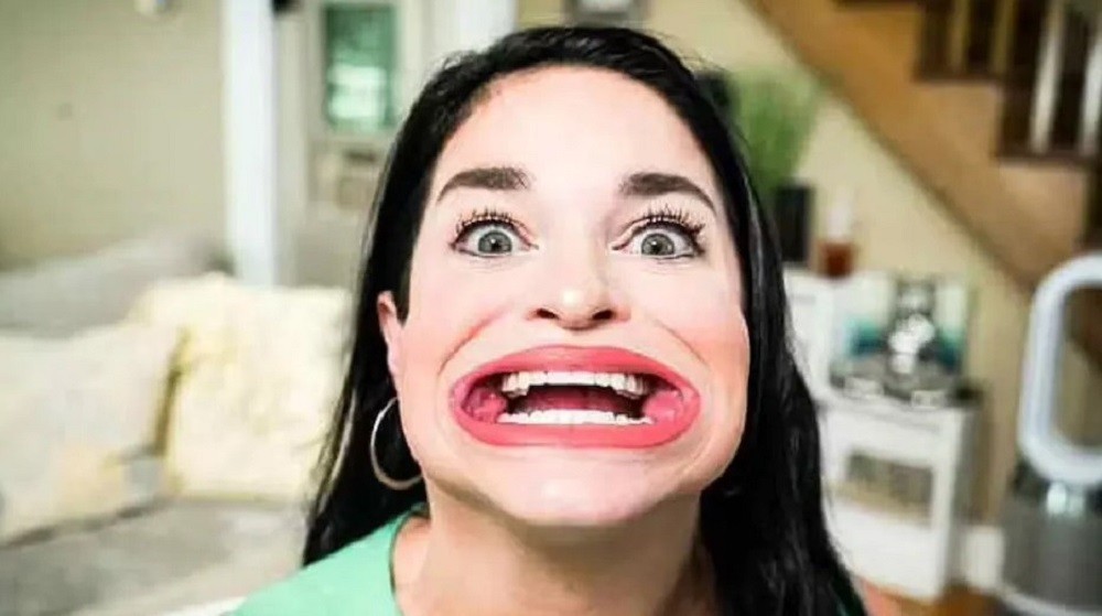 संसारको सबैभन्दा ठूलो मुख भएकी यी महिलाले बनाइन अनौठो रेकर्ड