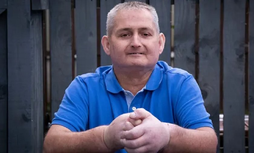 विश्वमा पहिलोपटक बेलायतले गर्यो दुवै हातको सफल प्रत्यारोपण