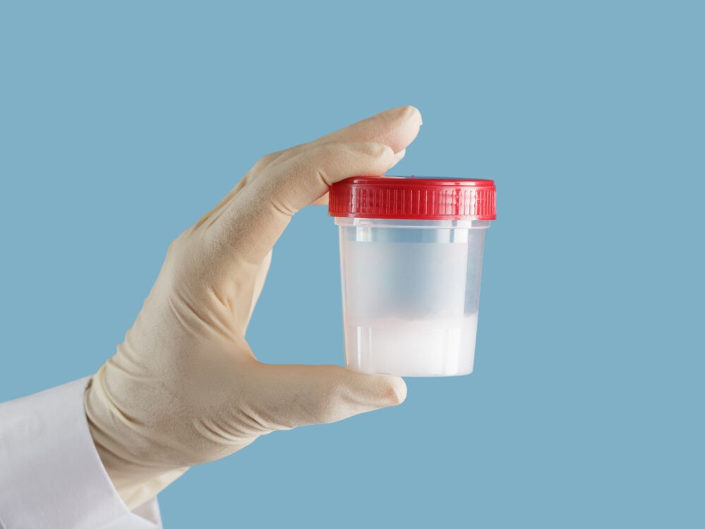 ५ सय ५० भन्दा धेरै बच्चा जन्माउन वीर्य दान गरेका व्यक्तिलाई अब वीर्य दान नगर्न आदेश