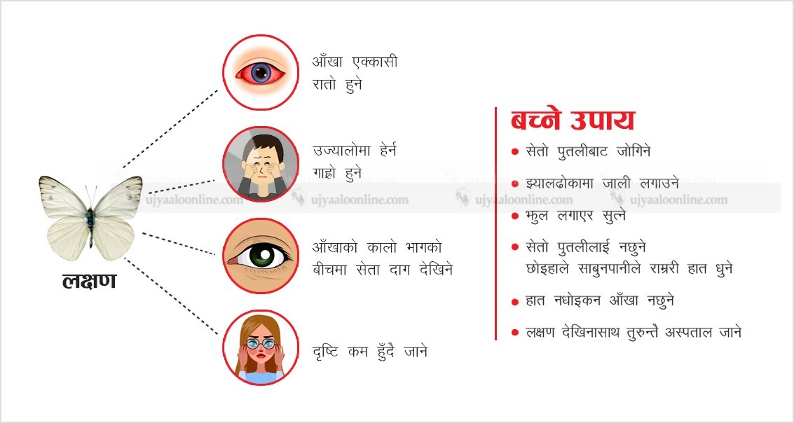 आँखाको दृष्टि नै गुम्न सक्ने खतरा रहेको सापु रोगका बिरामी बढ्न थाले